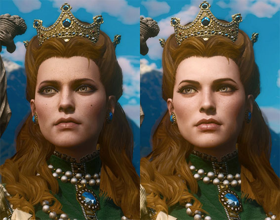 巫师3：狂猎角色去斑美容高清MOD整合包