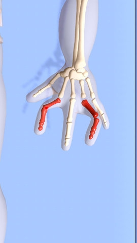 正骨老中医中文版