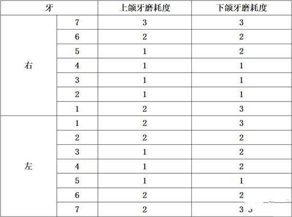 犯罪大师无名尸体年龄推断篇答案是什么 无名尸体年龄推断篇正确答案详解